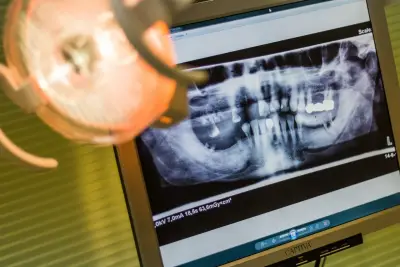 Имплантологичен кабинет BalevDental - Балев Дентал