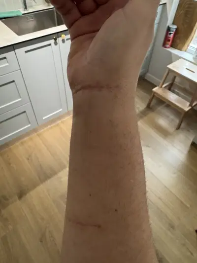 Hand Therapy Bulgaria