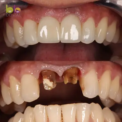 BB DENTAL CLINIC - Зъболекар в София Център