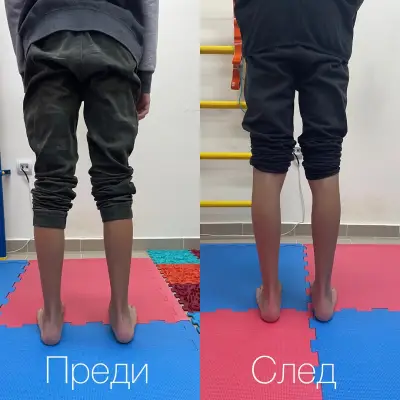 Медицински Център Физио Плюс - Физиотерапия и Рехабилитация | Physio Plus - гр.Пловдив. Договор с НЗОК