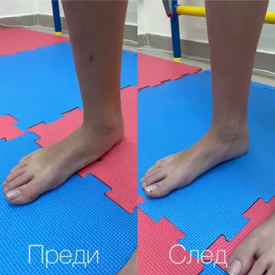 Медицински Център Физио Плюс - Физиотерапия и Рехабилитация | Physio Plus - гр.Пловдив. Договор с НЗОК