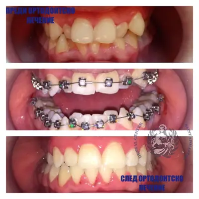 Dental Center “Saint Apollonia” Plovdiv