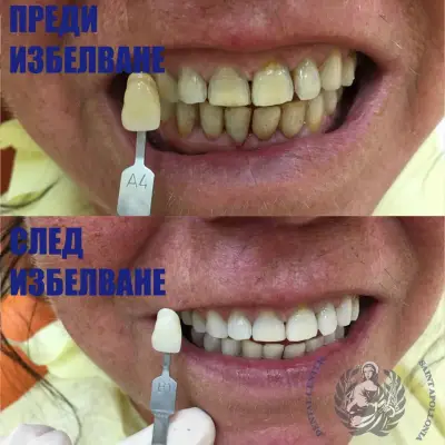 Dental Center “Saint Apollonia” Plovdiv