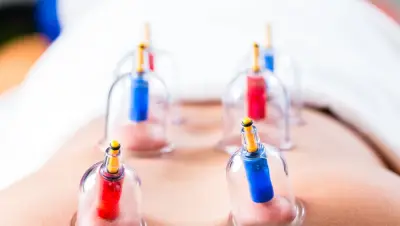 AY STAR Hijama