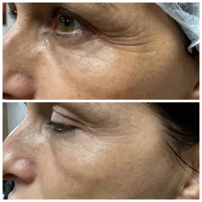Body correction Varna 2