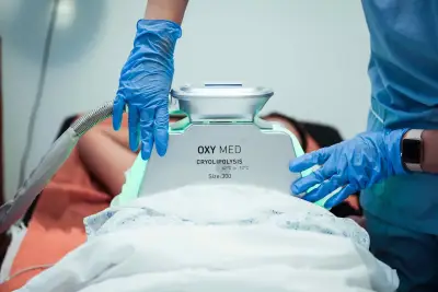 OXYMED - Криолиполиза VelaShape 3 Медико-козметични процедури