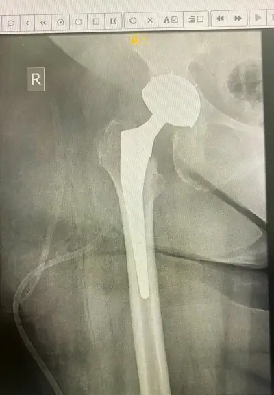 Ass. Prof. Dr. Stoyan Hristov MD, PhD - UNIVERSITY HOSPITAL BURGAS