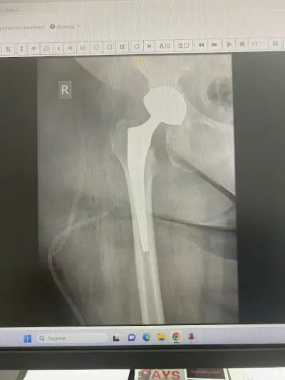 Ass. Prof. Dr. Stoyan Hristov MD, PhD - UNIVERSITY HOSPITAL BURGAS
