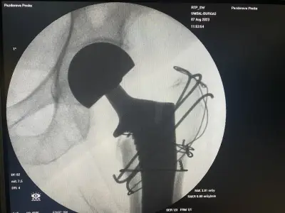 Ass. Prof. Dr. Stoyan Hristov MD, PhD - UNIVERSITY HOSPITAL BURGAS