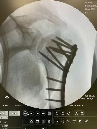 Ass. Prof. Dr. Stoyan Hristov MD, PhD - UNIVERSITY HOSPITAL BURGAS