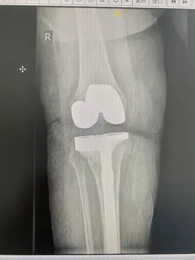 Ass. Prof. Dr. Stoyan Hristov MD, PhD - UNIVERSITY HOSPITAL BURGAS