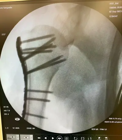 Ass. Prof. Dr. Stoyan Hristov MD, PhD - UNIVERSITY HOSPITAL BURGAS