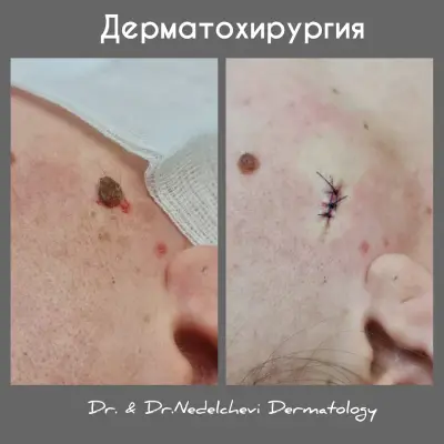 Dr. Nedelcheva - дерматология и естетика