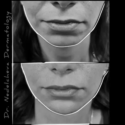 Dr. Nedelcheva - дерматология и естетика
