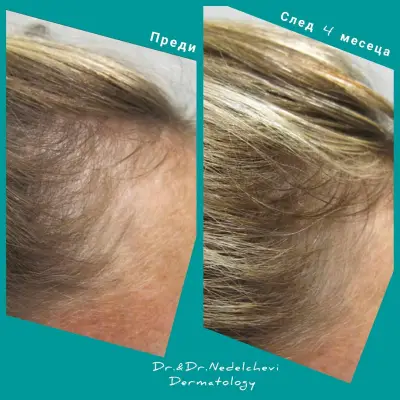 Dr. Nedelcheva - дерматология и естетика