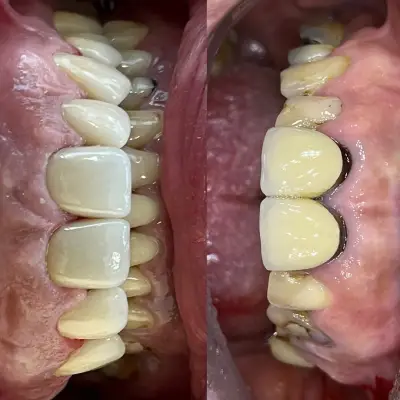 Дентално студио Dental Flower Д-р Цветелина Нейчева