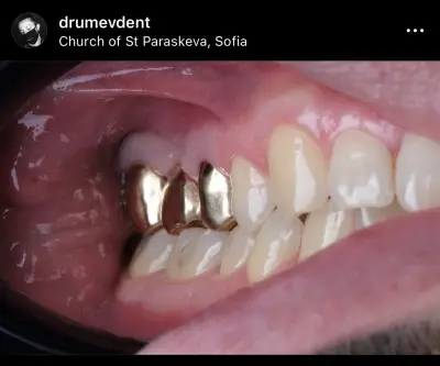 DrumevDent