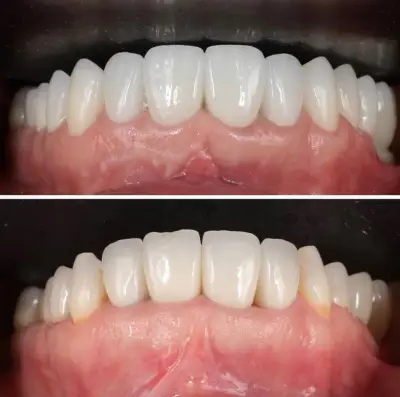 Д-р Ваня Липчева - Пародонтология | Имплантология | Естетика | Dr. Vanya Lipcheva - Periodontology | Implantology |