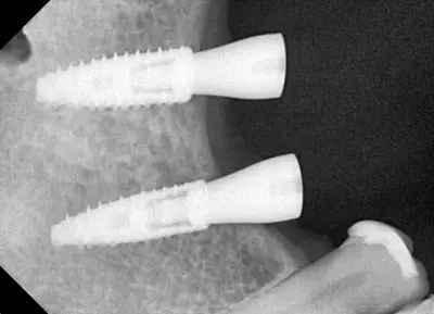 TD-DENT Dental Studio