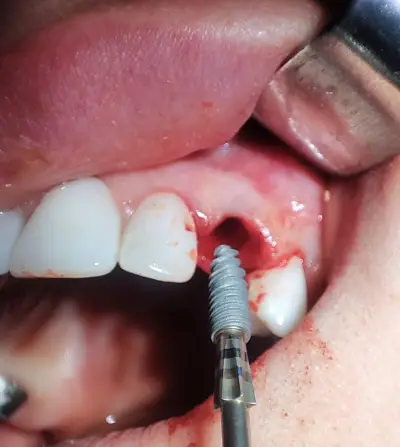 TD-DENT Dental Studio