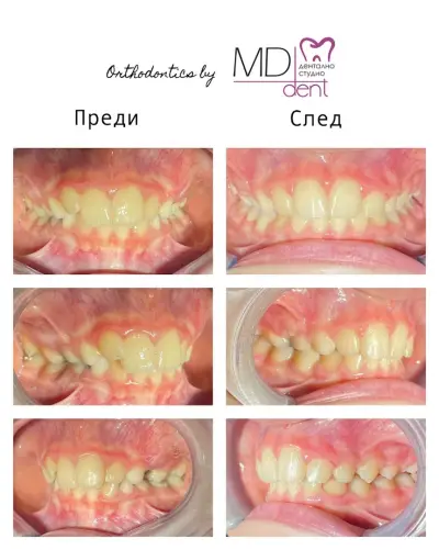 Dental Studio MD Dent Ltd Dupnitsa / Дентално студио МД Дент ООД гр. Дупница