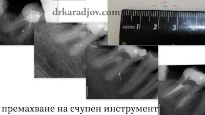 Д-р Светлин Караджов – зъболекар в Бургас, специализиран в ендодонтия под дентален микроскоп