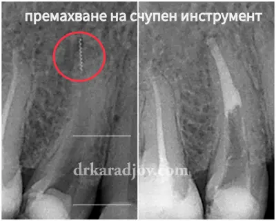 Д-р Светлин Караджов – зъболекар в Бургас, специализиран в ендодонтия под дентален микроскоп
