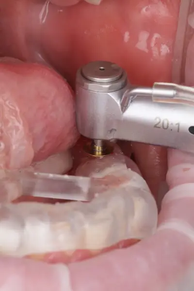 Др Димитър Димитров (зъболекар)