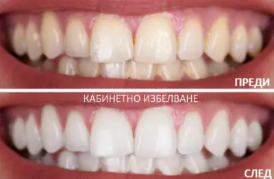 Зъболекарски кабинет д-р Лъчезар Хаджиев , Зъболекар в Пловдив