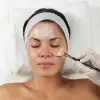 Химичен пилинг